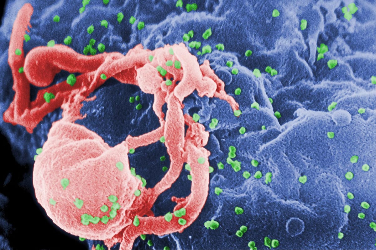 Oggi ricordiamo che la battaglia contro l’AIDS è quotidiana