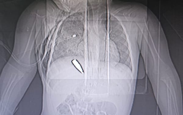 “Un massacro mascherato da aiuti umanitari”